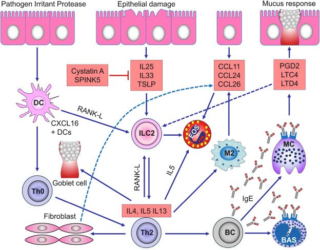 Krónikus rhinosinusitis patogenezise orrpolippal és kiemelkedő T2 endotípussal